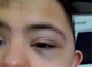 Down Sendromlu Öğrenciye Şiddet: Öğretmene Para Cezası