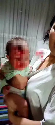 Ankara'da 4 Aylık Bebek Şiddete Uğradı